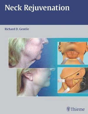 bokomslag Neck Rejuvenation