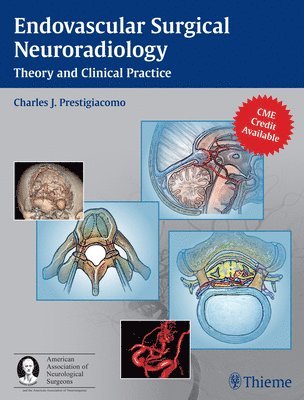 Endovascular Surgical Neuroradiology 1