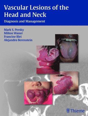 bokomslag Vascular Lesions of the Head and Neck