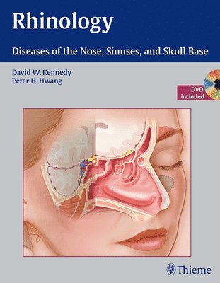Rhinology: Diseases of the Nose, Sinuses, and Skull Base 1