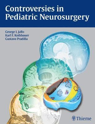George I. Jallo, Karl Kothbauer, Gustavo Pradilla, George I Jallo - Controversies in Pediatric Neurosurgery, Inbunden