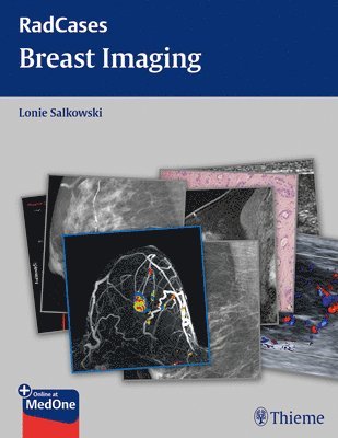 bokomslag Breast Imaging