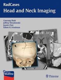 bokomslag RadCases Head and Neck Imaging