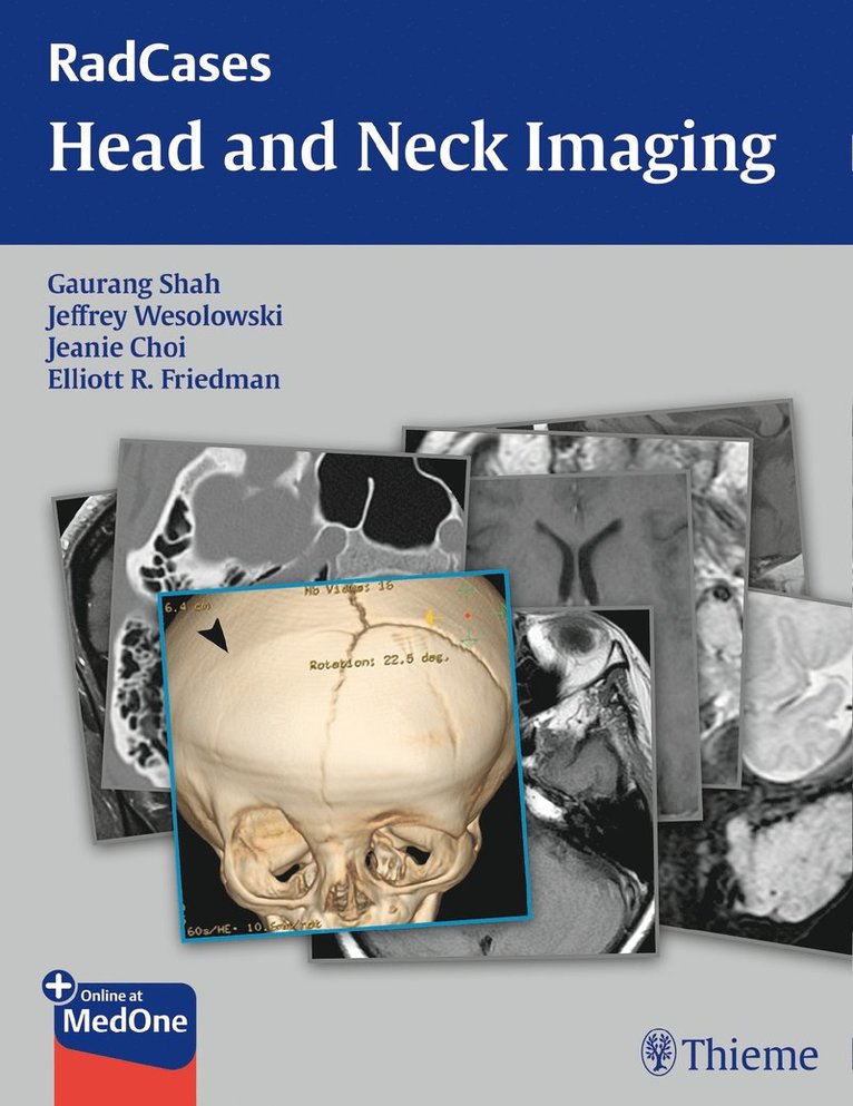 Gaurang Shah, Jeffrey Robert Wesolowski, Jeanie Choi, Elliott Friedman - RadCases Head and Neck Imaging, Häftad