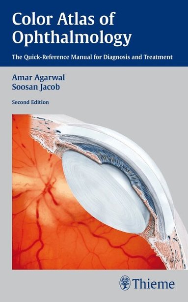 Amar Agarwal, Soosan Jacob - Color Atlas of Ophthalmology, Häftad