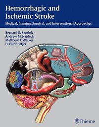 bokomslag Hemorrhagic and Ischemic Stroke: Medical, Imaging, Surgical and Interventional Approaches