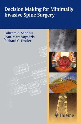 Faheem A. Sandhu, Jean-Marc Voyadzis, PhD Fessler, Richard Glenn, MD - Decision Making for Minimally Invasive Spine Surgery, Häftad