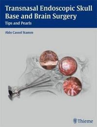 bokomslag Transnasal Endoscopic Skull Base and Brain Surgery: Tips and Pearls
