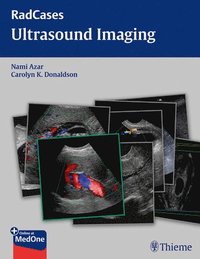 bokomslag Radcases Ultrasound Imaging