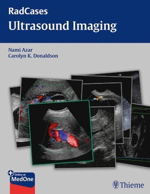 Radcases Ultrasound Imaging 1