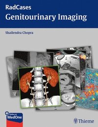 bokomslag Genitourinary Imaging