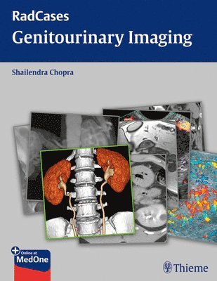 bokomslag Radcases Genitourinary Imaging
