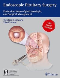 bokomslag Endoscopic Pituitary Surgery: Endocrine, Neuro-Ophthalmologic and Surgical Management