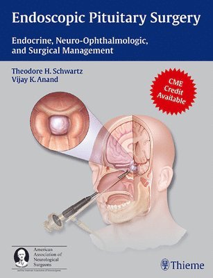 Theodore H. Schwartz, Vijay K. Anand, Theodore H Schwartz, Vijay K Anand - Endoscopic Pituitary Surgery, Inbunden