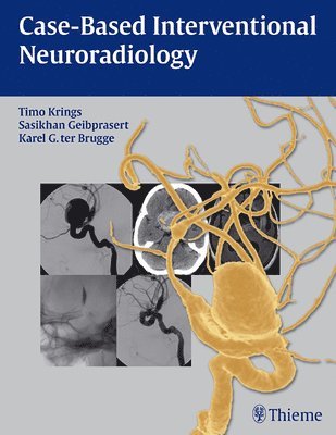 bokomslag Case-Based Interventional Neuroradiology