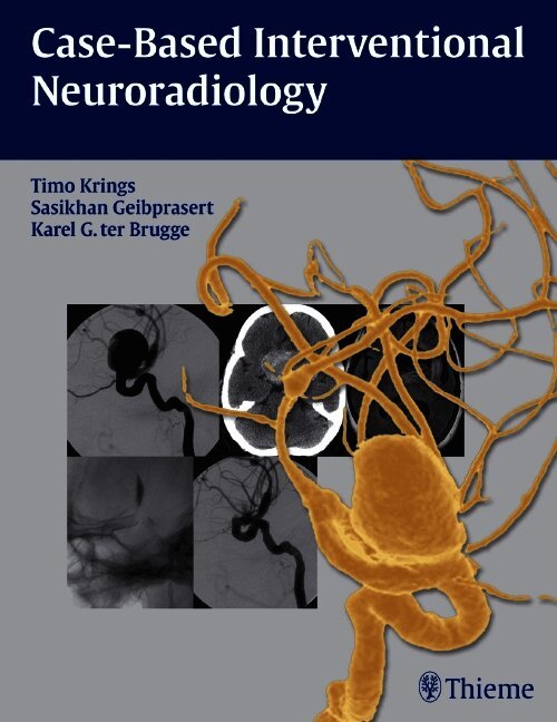 Case-Based Interventional Neuroradiology