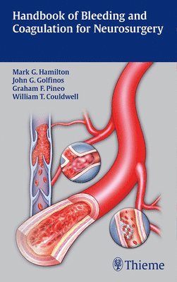 Handbook of Bleeding and Coagulation for Neurosurgery 1