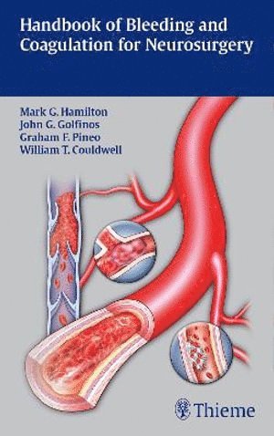 Mark G. Hamilton, John G. Golfinos, Graham Pineo, William T. Couldwell, Mark G Hamilton, John G Golfinos, William T Couldwell - Handbook of Bleeding and Coagulation for Neurosurgery, Häftad