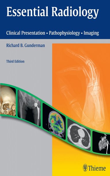 Richard B. Gunderman - Essential Radiology, Häftad