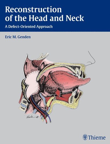 Eric M. Genden, Eric M Genden - Reconstruction of the Head and Neck, Inbunden
