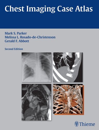 Mark S. Parker, Melissa L. Rosado-de-Christenson, Gerald F. Abbott - Chest Imaging Case Atlas, Inbunden
