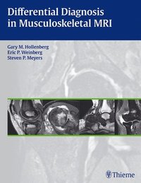 bokomslag Differential Diagnosis in Musculoskeletal MR