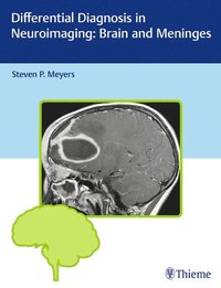 bokomslag Differential Diagnosis in Neuroimaging: Brain and Meninges