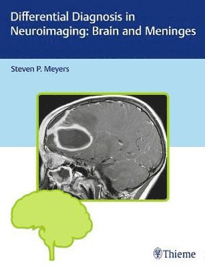 bokomslag Differential Diagnosis in Neuroimaging: Brain and Meninges