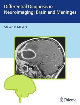 Differential Diagnosis in Neuroimaging: Brain and Meninges 1