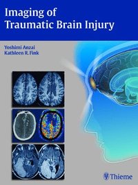 bokomslag Imaging of Traumatic Brain Injury
