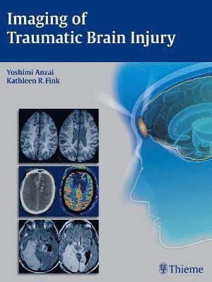 bokomslag Imaging of Traumatic Brain Injury