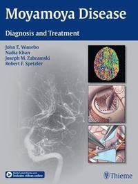 bokomslag Moyamoya Disease: Diagnosis and Treatment