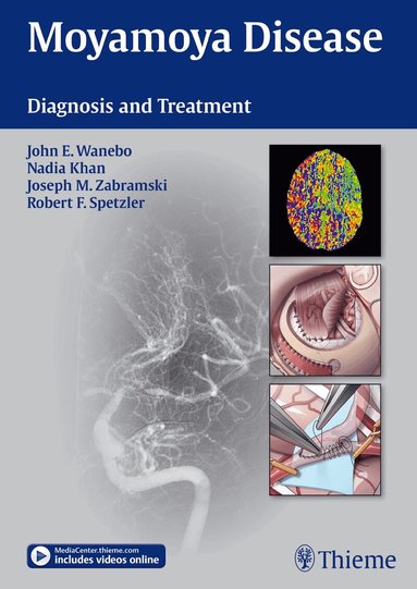 John E. Wanebo, Nadia Khan, Joseph M. Zabramski, Robert F. Spetzler - Moyamoya Disease, Inbunden
