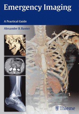 Alexander Baxter - Emergency Imaging, Häftad