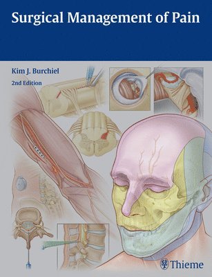 bokomslag Surgical Management of Pain