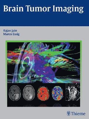 bokomslag Brain Tumor Imaging