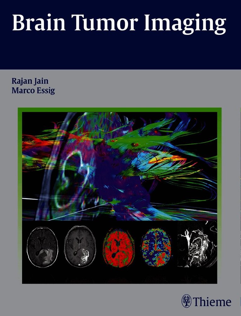 Brain Tumor Imaging