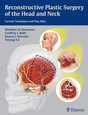 Matthew M. Hanasono, Geoffrey L. Robb, Roman J. Skoracki, Peirong Yu, Matthew M Hanasono, Geoffrey L Robb, Roman J Skoracki - Reconstructive Plastic Surgery of the Head and Neck, Inbunden