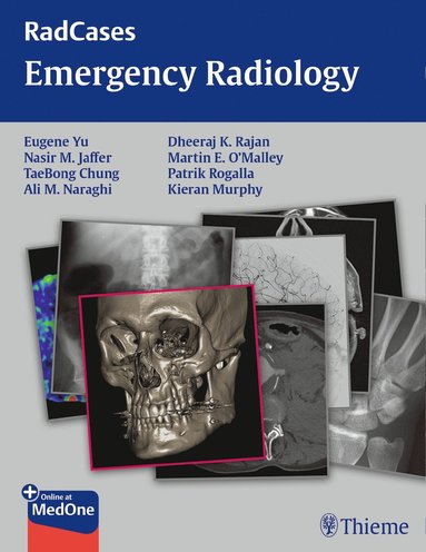 bokomslag Radcases Emergency Radiology