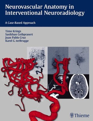 bokomslag Neurovascular Anatomy in Interventional Neuroradiology