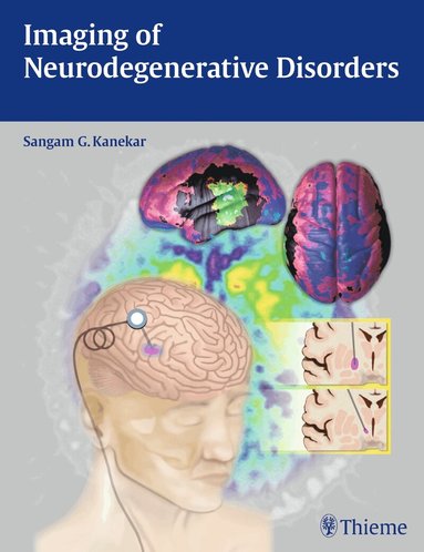 Sangam Kanekar - Imaging of Neurodegenerative Disorders, Inbunden
