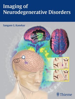 bokomslag Imaging of Neurodegenerative Disorders
