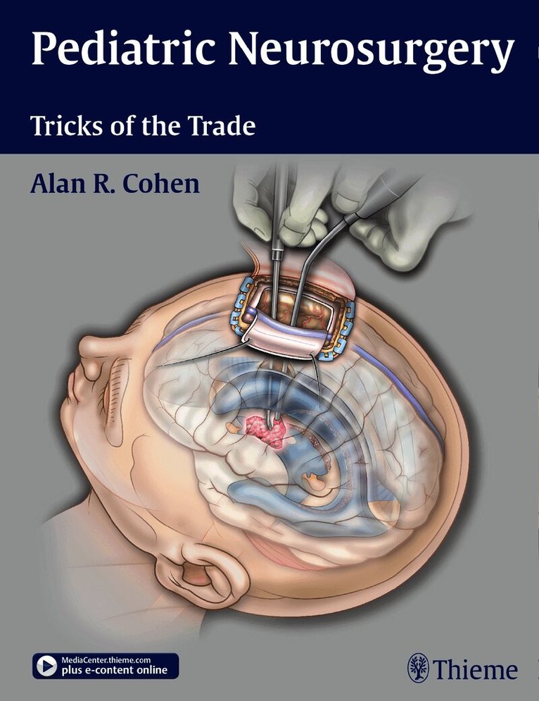 Pediatric Neurosurgery: Tricks of the Trade