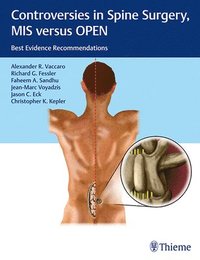 bokomslag Controversies in Spine Surgery, MIS Versus OPEN