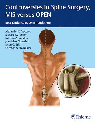 Controversies in Spine Surgery, MIS versus OPEN 1