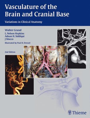 Vasculature of the Brain and Cranial Base 1