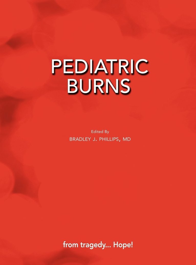 Pediatric Burns