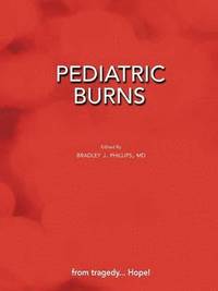 bokomslag Pediatric Burns (Paperback Edition)