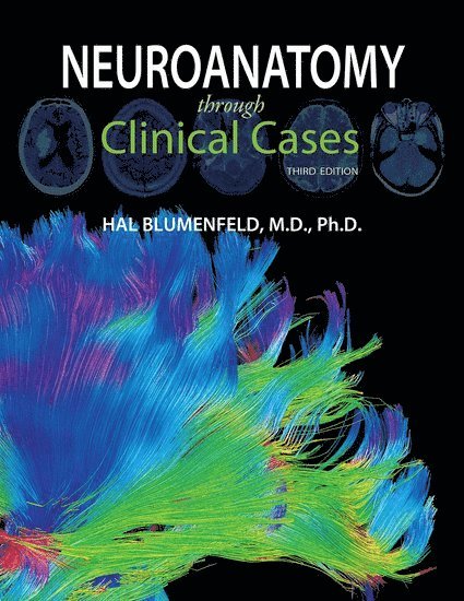 Hal Blumenfeld, Yale University School of Medicine) Blumenfeld, Hal (Professor, Departments of Neurology, Neuroscience, and Neurosurgery, Professor, Departments of Neurology, Neuroscience, and Neurosurgery - Neuroanatomy through Clinical Cases, Häftad