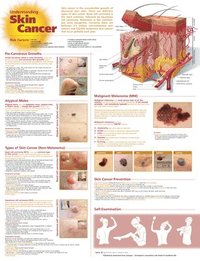 bokomslag Understanding Skin Cancer Anatomical Cha